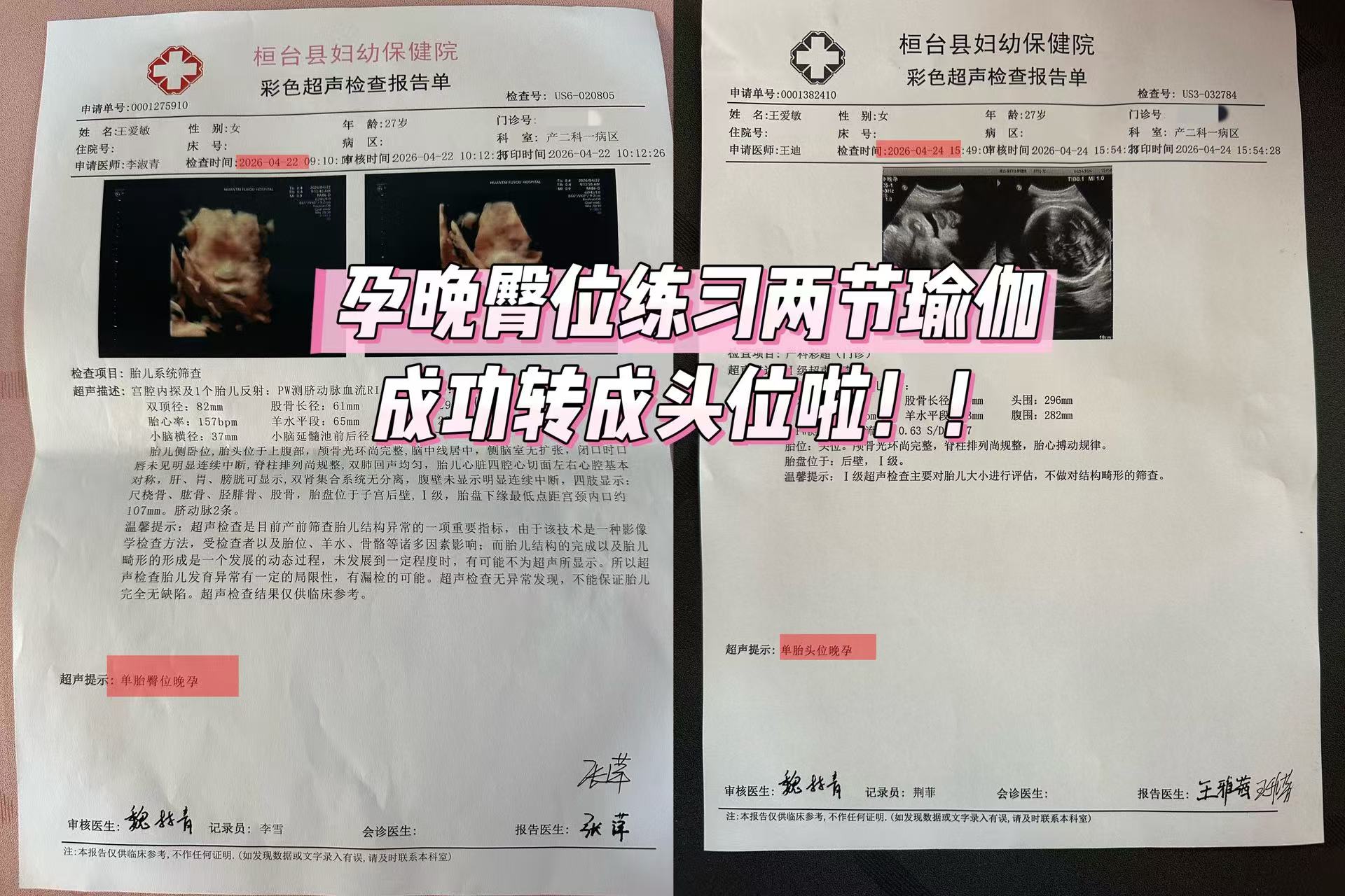 苗若彤孕产瑜伽：孕期瑜伽安全吗？专业孕产瑜伽导师为你解答